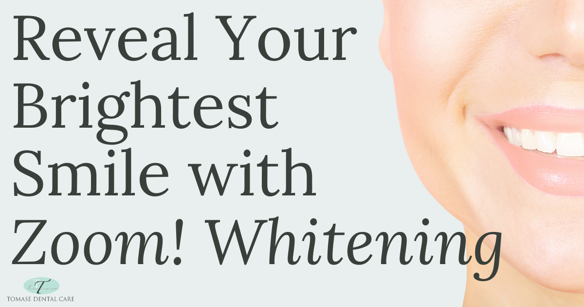 Tomase Email Feb 2025