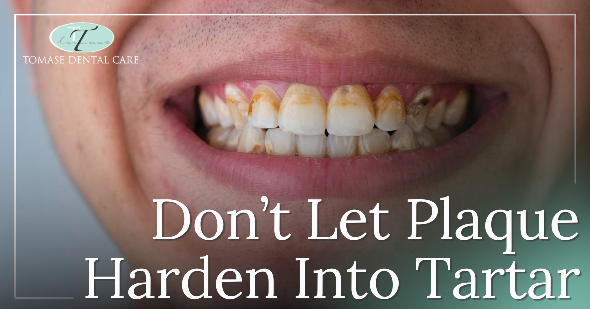 teeth with tartar